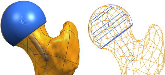 Retinacular Arteries Of Hip