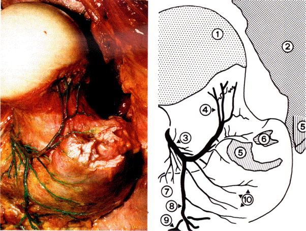 Retinacular Arteries Of Hip